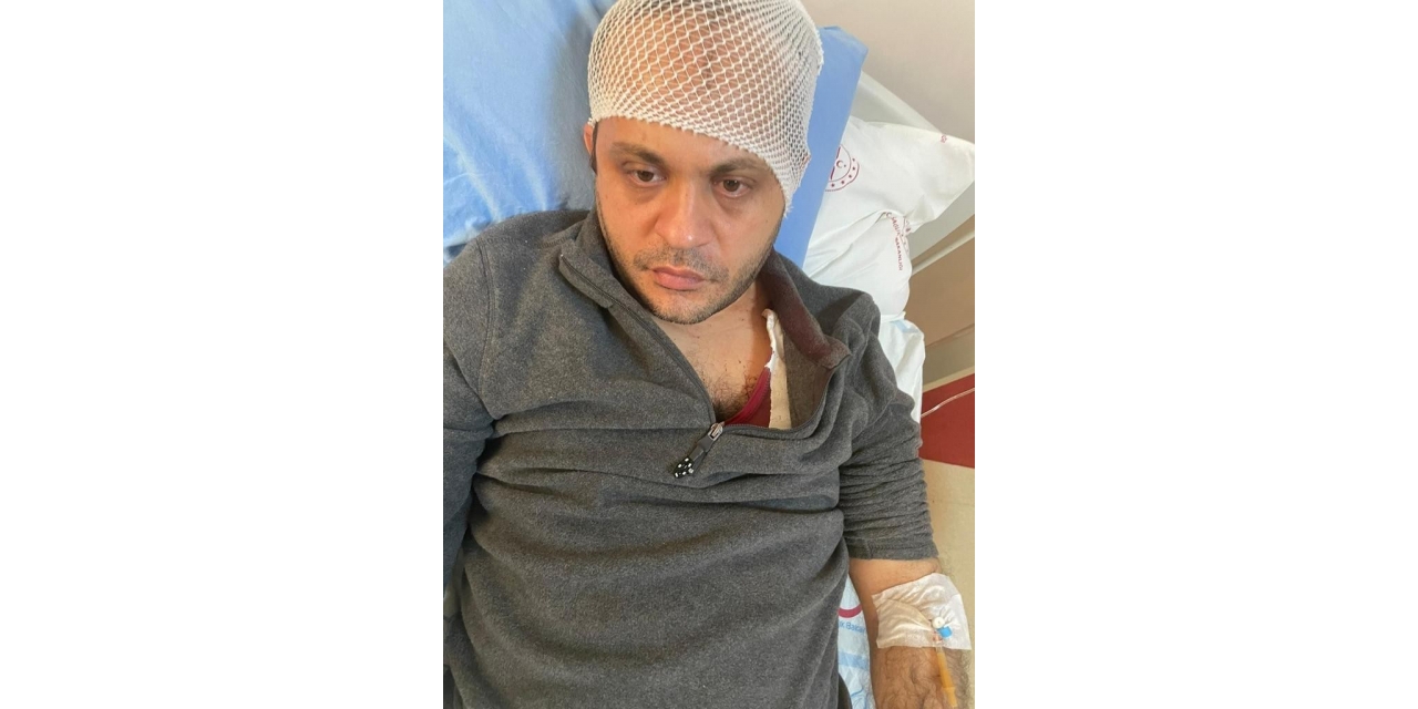 Gaziantep’te Hasta Yakınından Doktora Mermerli Saldırı