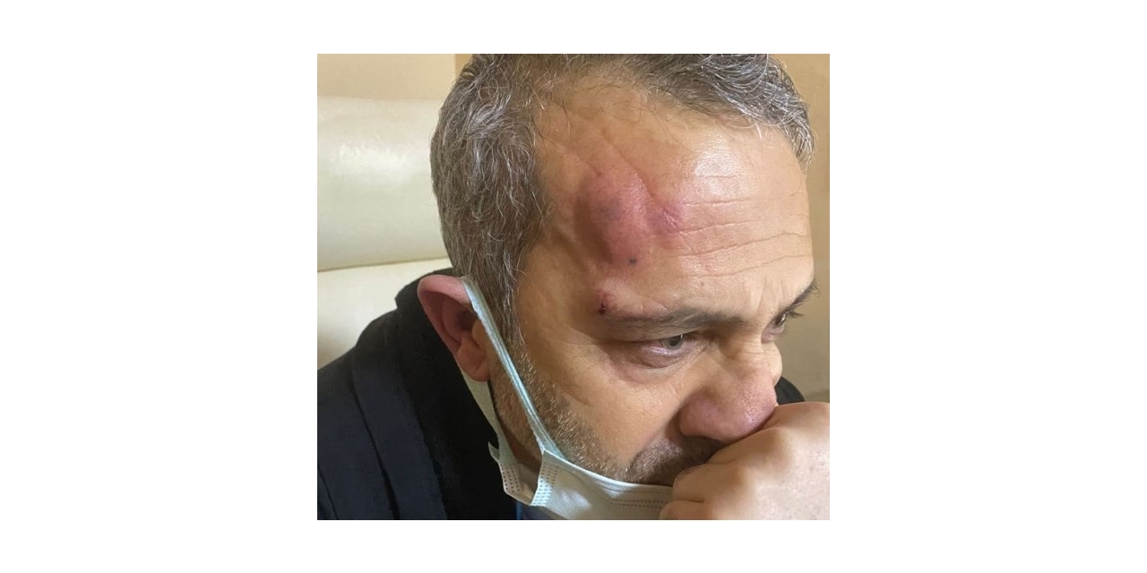 Şanlıurfa’da Hasta Yakınları Sağlık Çalışanını Darp Etti