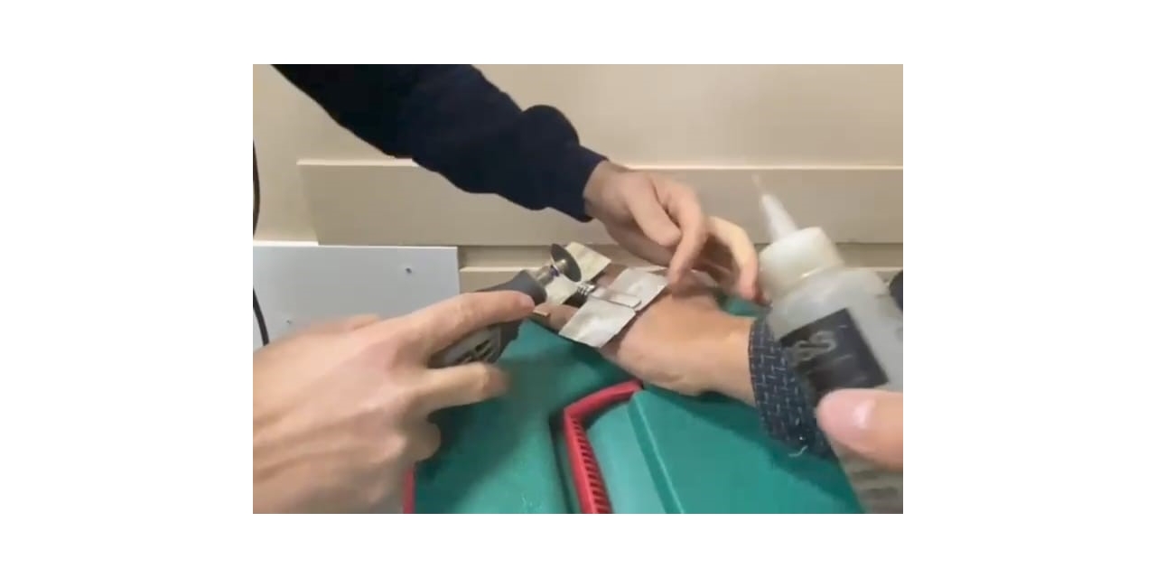 Parmağa Sıkışan Yüzüğü İtfaiye Keserek Çıkardı