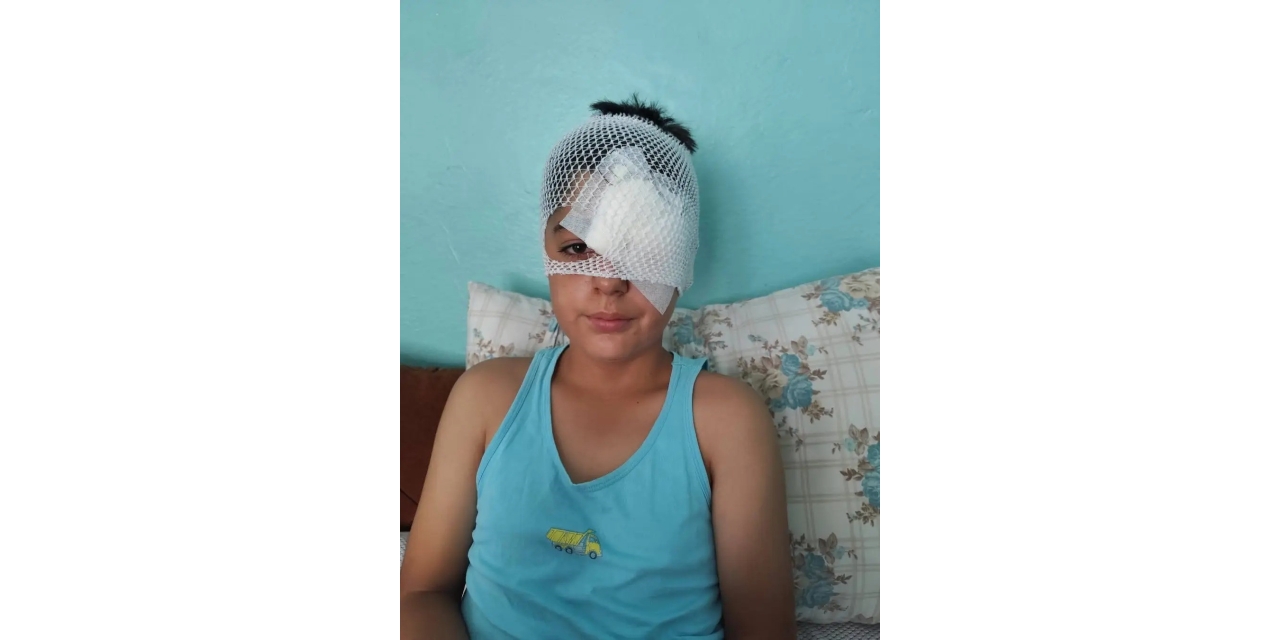 Şanlıurfa’da Köpek Saldırısından Kaçan Çocuğa Otomobil Çarptı