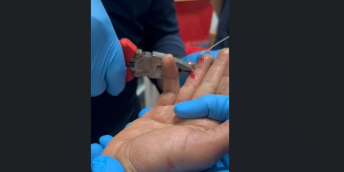 Balık Macerası Hastanede Bitti