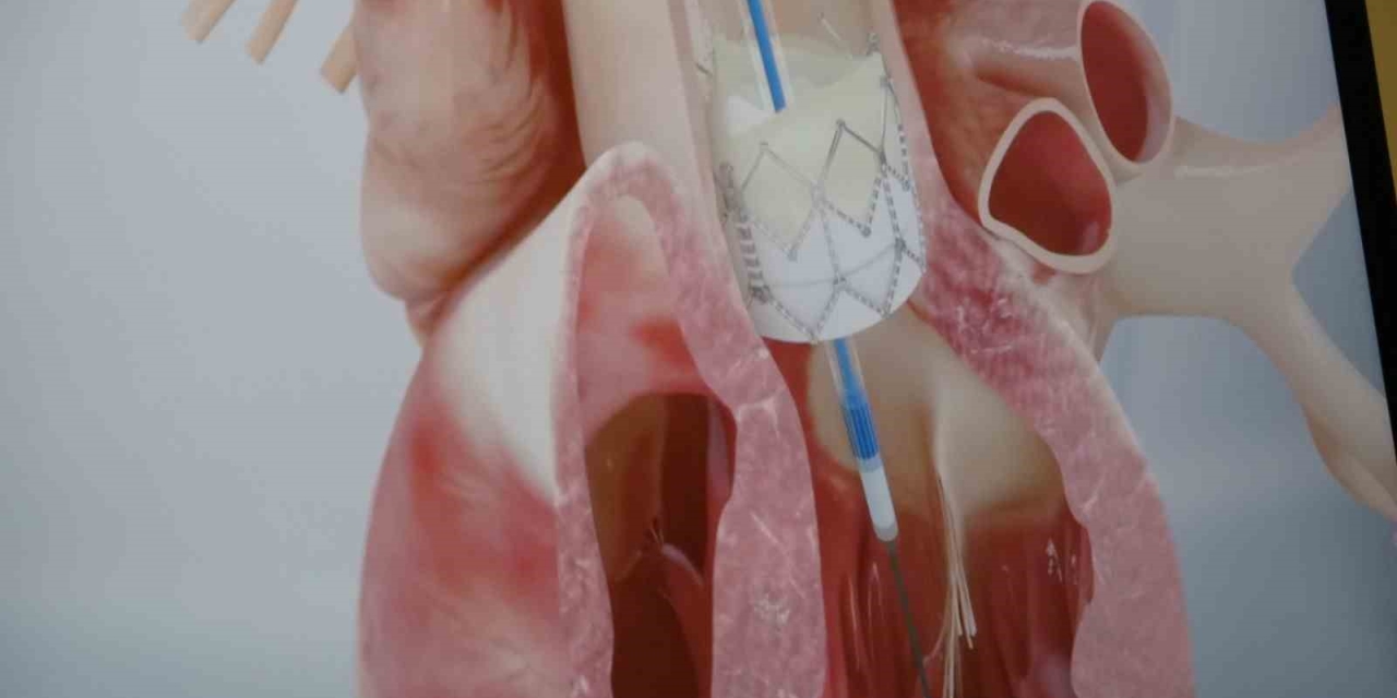 Prof. Dr. Pekdemir: "gençlerde Ani Ölümlerin Yüzde 90’ı Genetik Nedenlerden Kaynaklanıyor"