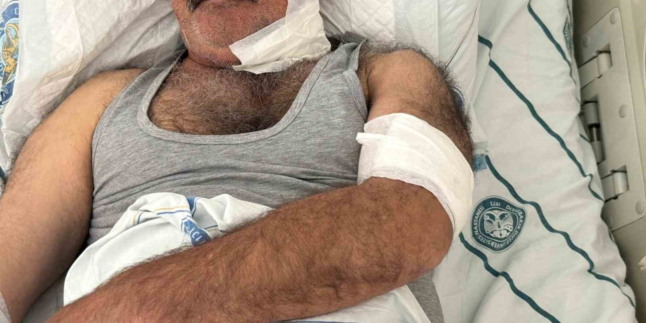 At Sahibini Boğazından Isırarak Ağır Yaraladı