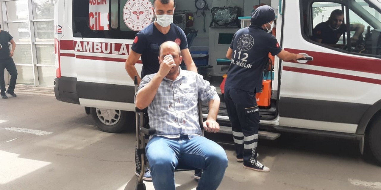 Tazyikli Suyla Yüzünü Kesti