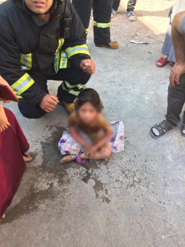 Alevler Arasında Kalan 2 Kardeş Ağır Yaralandı