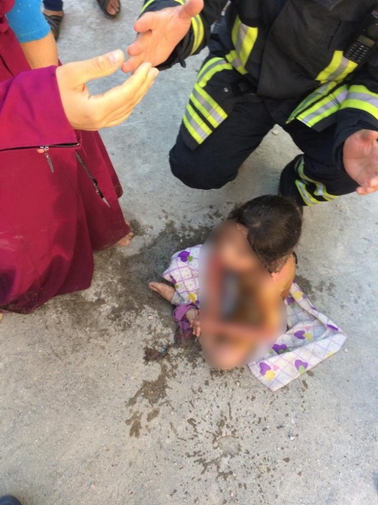 Alevler Arasında Kalan 2 Kardeş Ağır Yaralandı