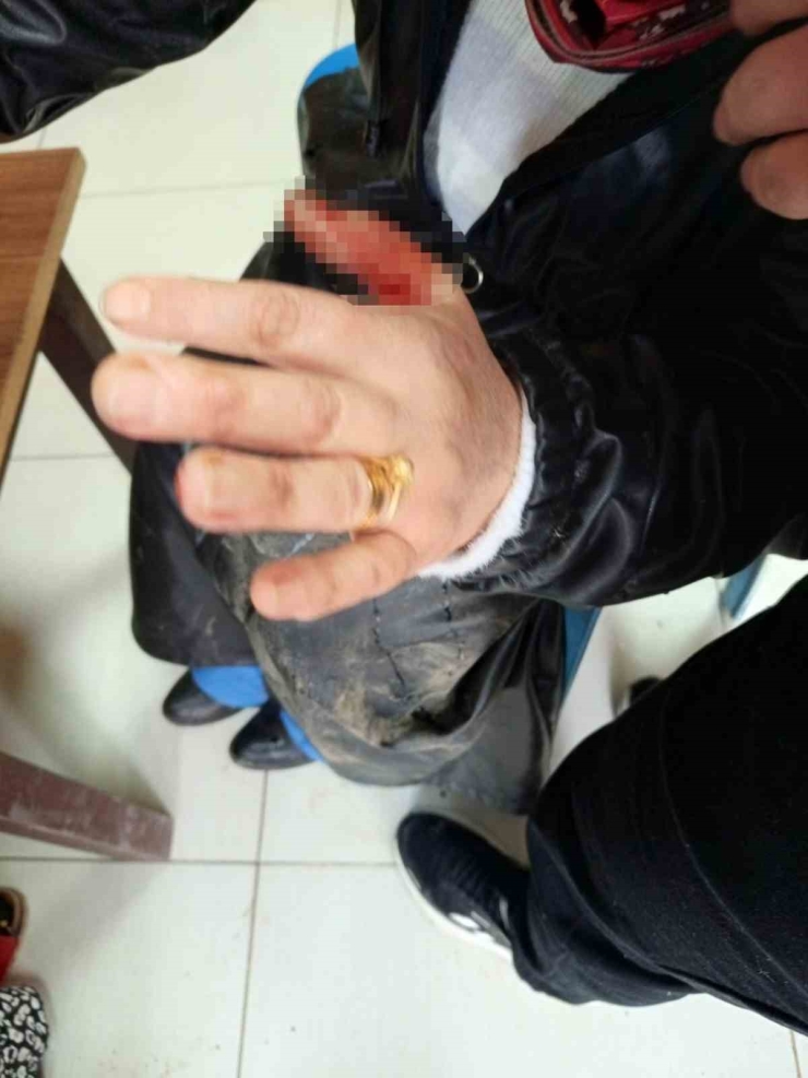 Diyarbakır’da Başıboş Sokak Köpeği Dehşeti