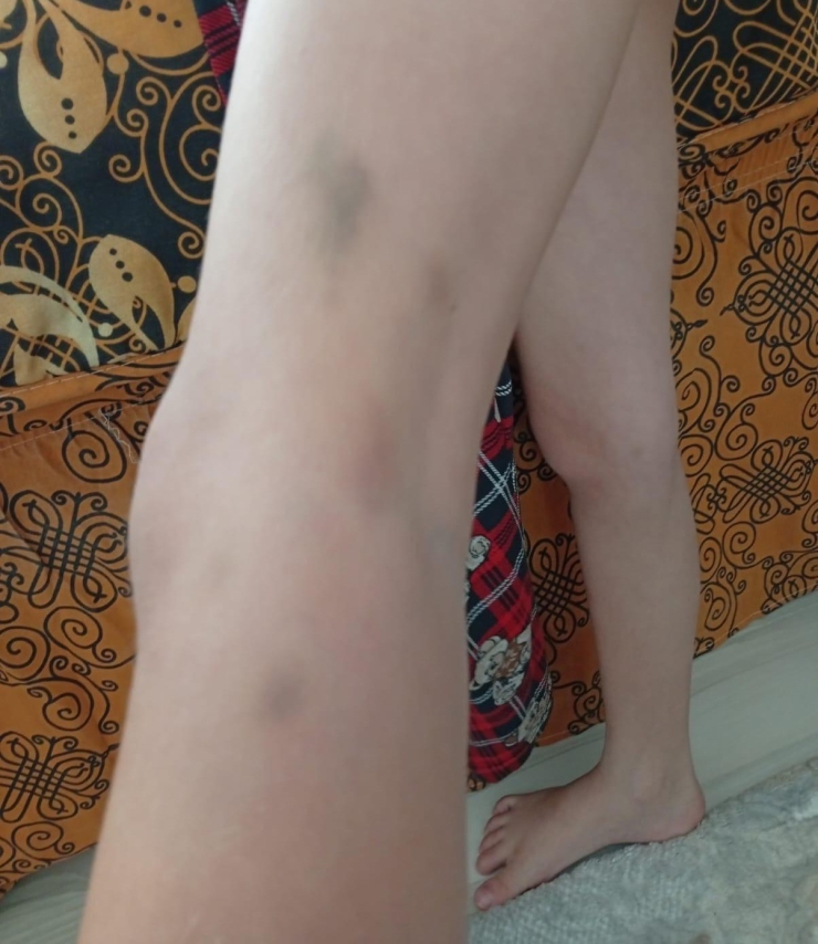 Boşanma Ve Velayet Davası 3 Yıl Sürdü, 7 Yaşındaki Çocuğun Velayeti, Raporlara Rağmen Babaya Verildi