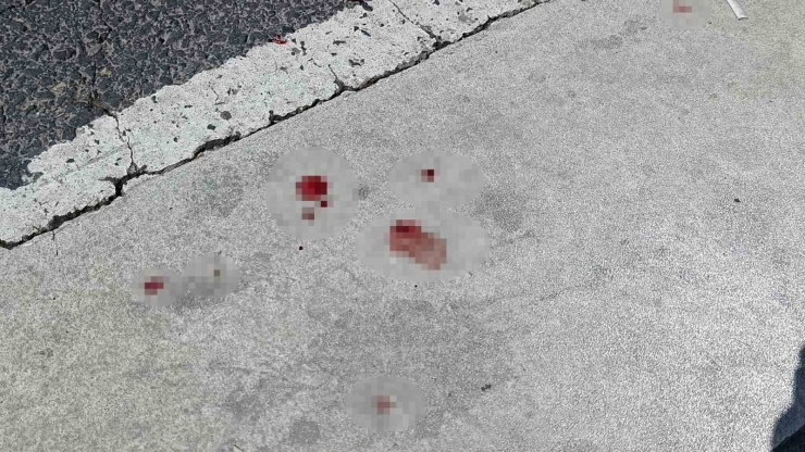 Şanlıurfa’da Özel Halk Otobüsünün Çarptığı Kişi Yaralandı