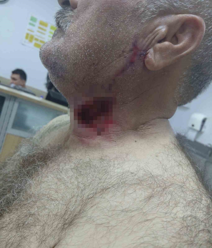 At Sahibini Boğazından Isırarak Ağır Yaraladı