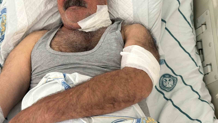 At Sahibini Boğazından Isırarak Ağır Yaraladı