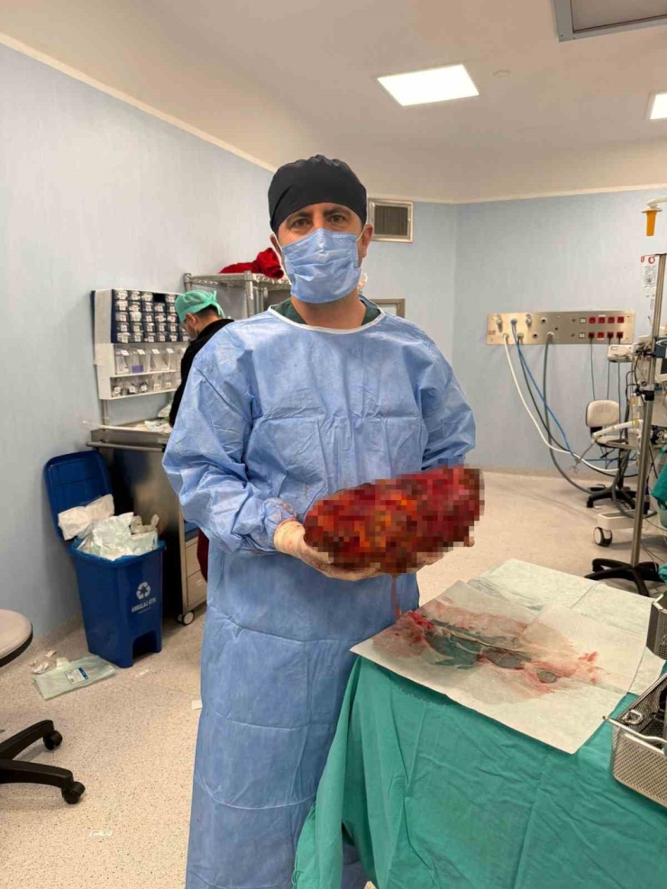 Karnında 8 Kiloluk Böbrekle Yaşayan Hasta, 30 Dakikalık Ameliyatla Sağlığına Kavuştu